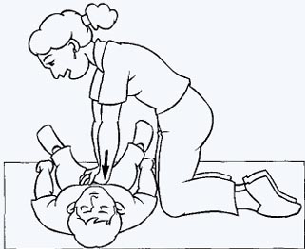 Reanimacion cardio pulmonar